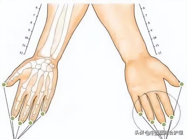 人体穴位分布图（「穴位科普」30个有神奇疗效的经外奇穴）(8)