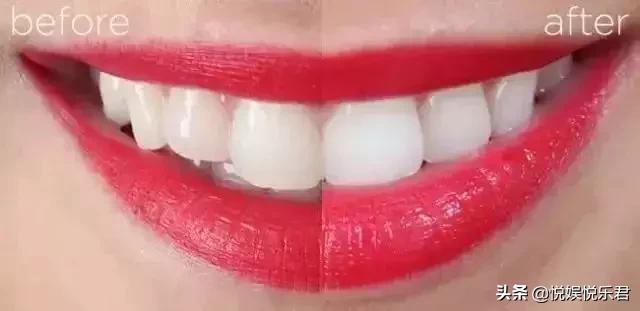 最好的美白牙齿牙膏（美白牙齿哪款牙膏更好用）(12)