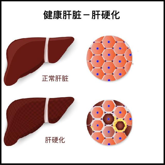 常规体检项目表（体检漏掉这些等于白做）(9)