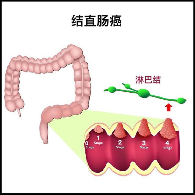 常规体检项目表（体检漏掉这些等于白做）(11)