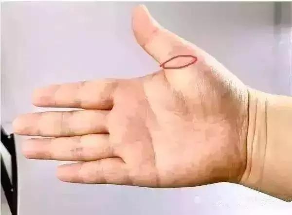 人体手部的穴位（五个手指对应五个身体系统）(10)
