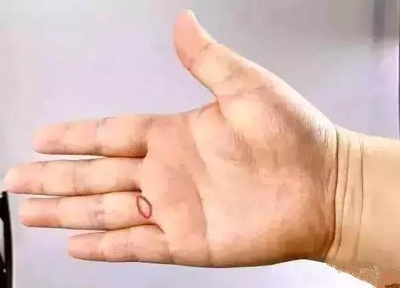人体手部的穴位（五个手指对应五个身体系统）(11)