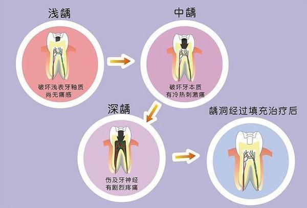 口腔疾病有哪些(4)