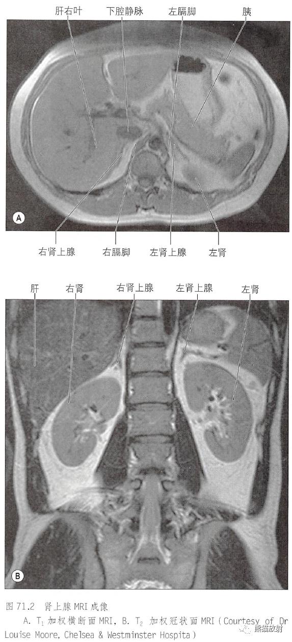 肾脏解剖结构图（解剖丨脾肾上腺泌尿生殖发育）(10)