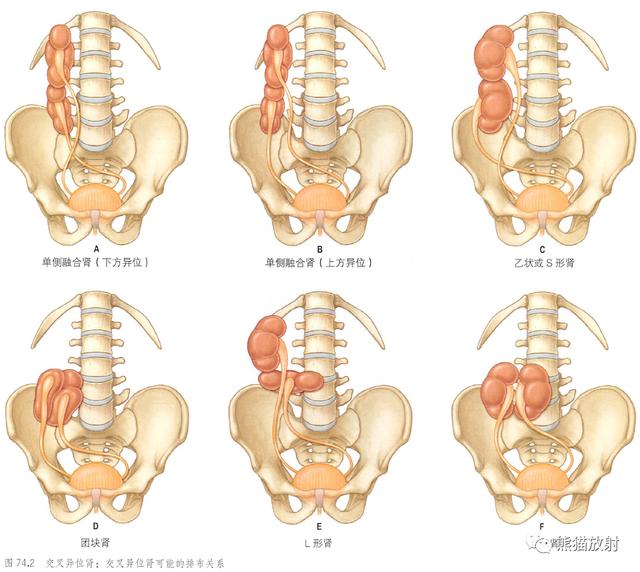 肾脏解剖结构图（解剖丨脾肾上腺泌尿生殖发育）(18)
