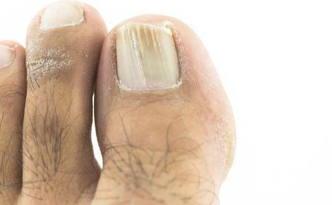 脚趾发麻是什么原因（经常出现脚趾麻木的5大因素）(1)