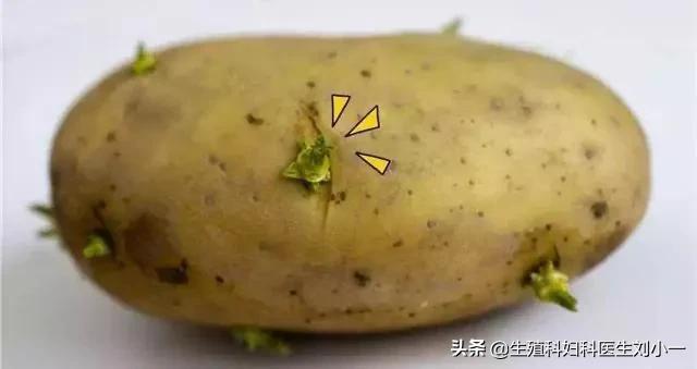 吃了发芽的土豆怎么办（发芽土豆中毒健康处方）(1)