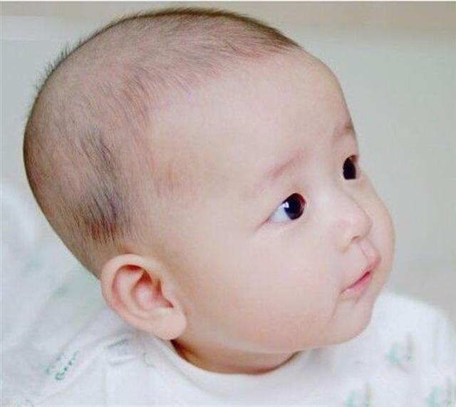 婴儿卤门凹陷图片（宝宝的囟门暗示宝宝的发育状况）(4)