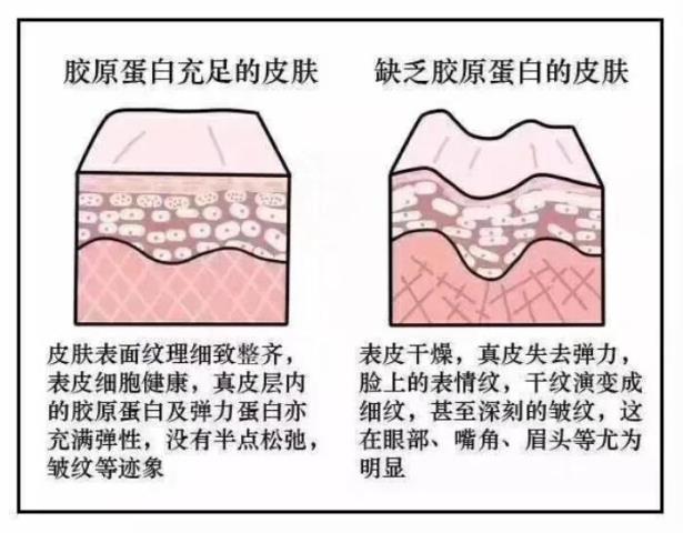 胶原蛋白的补充（如何正确的补充胶原蛋白）(6)