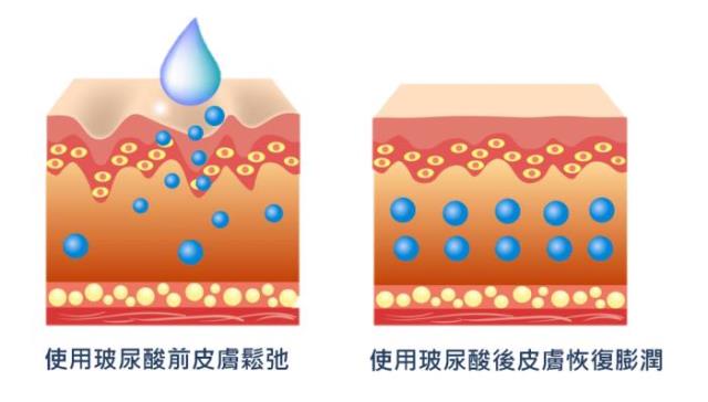 玻尿酸的作用与危害（你应该知道的玻尿酸常识）(3)