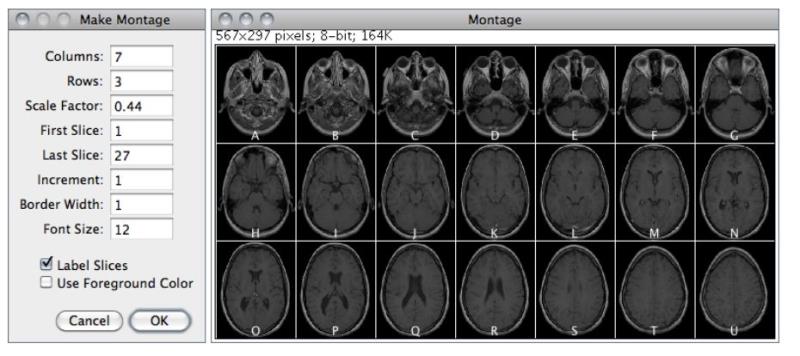 imagej灰度分析结果（imagej灰度分析使用步骤）(5)