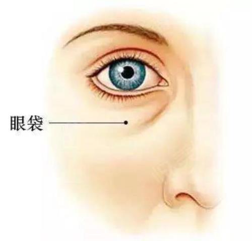 眼袋大是什么原因（造成眼袋大的原因是什么）(3)
