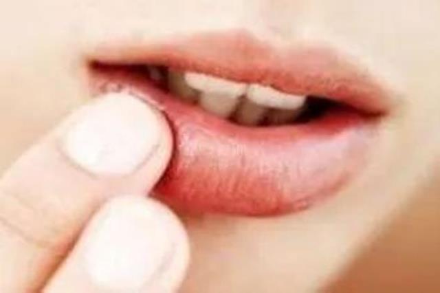 嘴唇发麻是什么原因（嘴唇发麻可能有这些疾病）