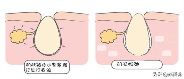 用热水洗脸好吗（我终于知道洗脸最佳水温了）(3)