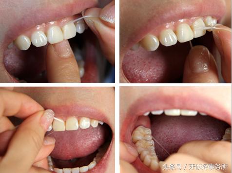 牙线如何使用（牙线的正确使用办法）(3)
