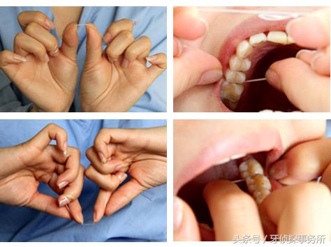 牙线如何使用（牙线的正确使用办法）(5)