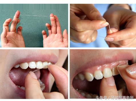 牙线如何使用（牙线的正确使用办法）(2)