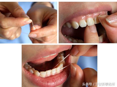 牙线如何使用（牙线的正确使用办法）(4)