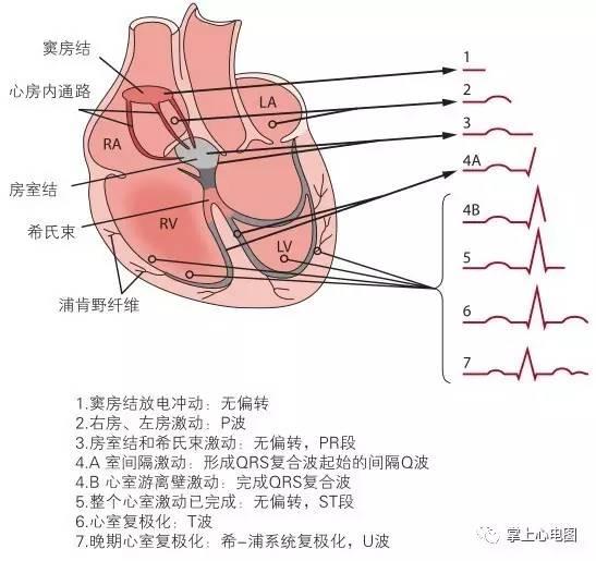一张图教你看懂心电图（3分钟基础心电图讲解连载）(3)
