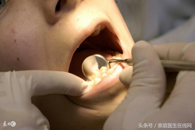 一般得了口腔癌什么时候会发现（口腔癌十分常见）(2)