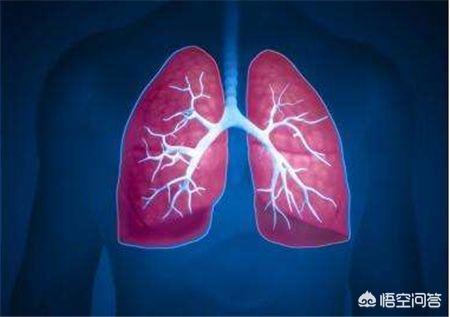 间质性肺炎和肺癌症状区分（间质性肺炎是一种什么样的疾病）(1)