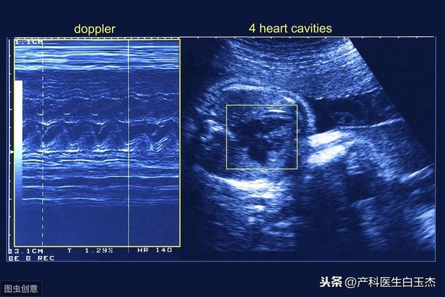 孕期胎儿心脏检查怎么查（这项检查在孕期很重要）(2)