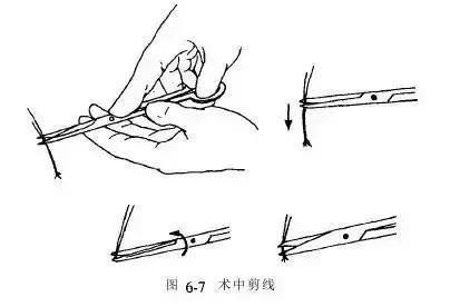 最常用的外科打结方法（干货图文并茂外科打结技能详解）(9)