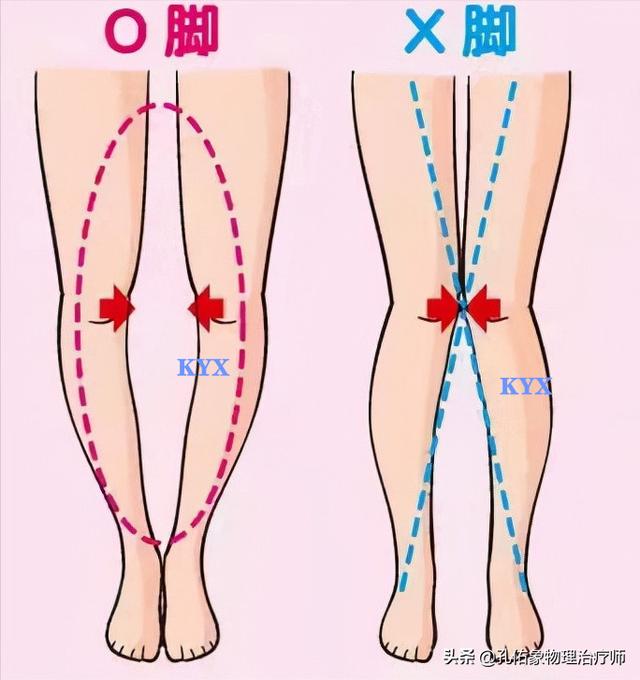 膝关节疼痛可能有三种病（为何发生膝关节疼痛）(5)