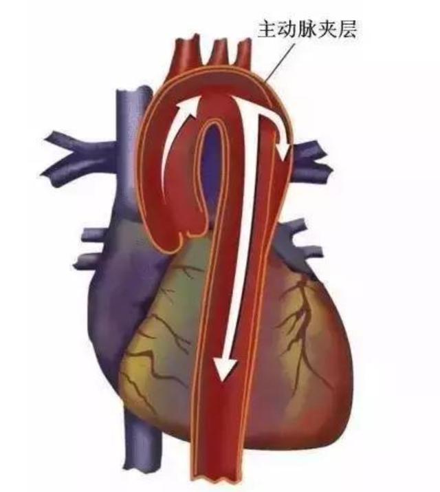 最近感觉胸痛是什么原因引起的 胸痛是什么原因(2)