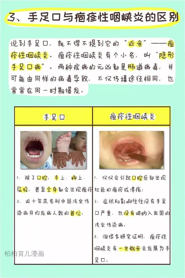 如何及早发现手足口病（10张图让你全面了解儿童手足口病）(2)
