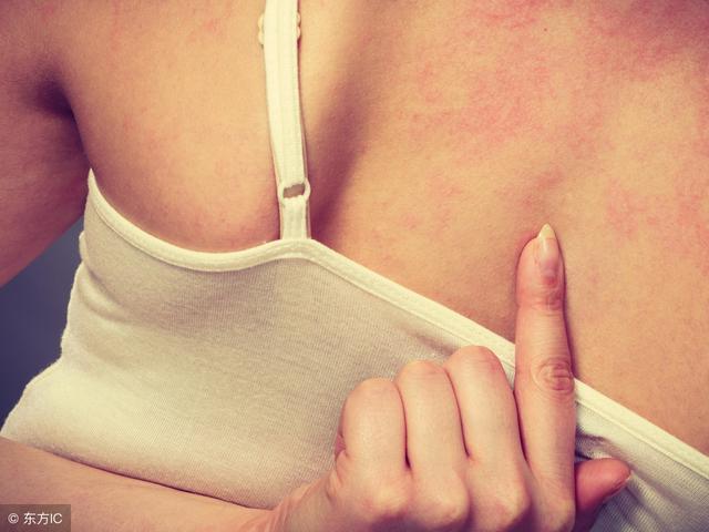 皮炎性湿疹是怎么导致的（熟知皮炎湿疹病的各种症状表现）(1)