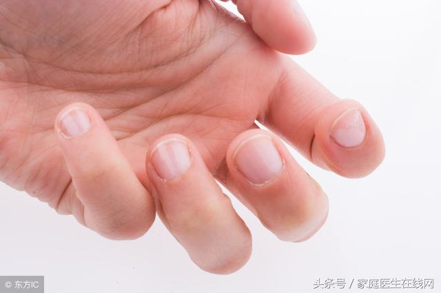 手指甲中下凹陷是怎么回事（手指甲凹陷预示身体疾病）(2)