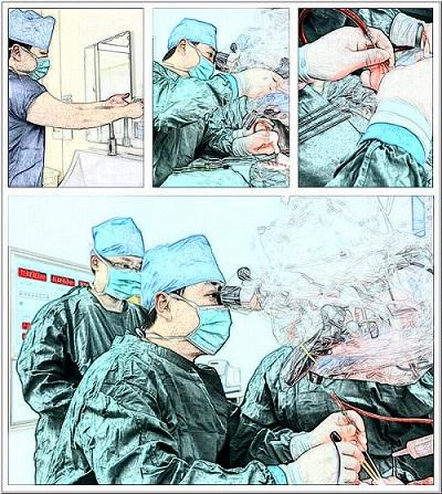 什么是神经外科微创手术（什么是神经外科微创手术）(3)