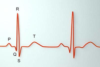 心电图表示窦性心律不齐是怎样了（心电图发明窦性心律不齐怎样办）