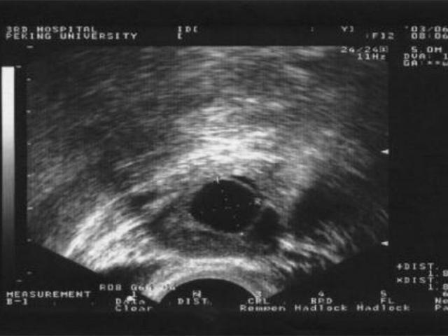 排卵期备孕规律（排卵期做足功课还是怀不上）(6)