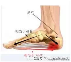 如何防止足跟痛复发（我是如何治疗自己的足跟痛）(2)
