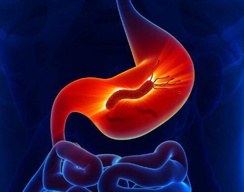 肠胃疼痛呕吐腹泻是什么病（肠胃若有3种疾病）(2)