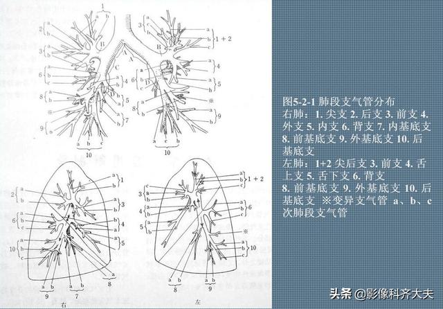 胸部断层解剖学详解（胸部解剖线条图）(2)