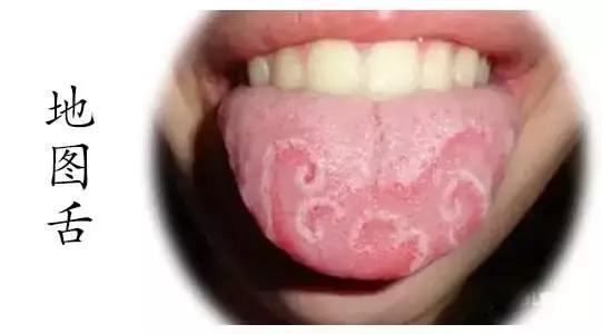 正确的舌诊（掌握舌诊魔术）(3)