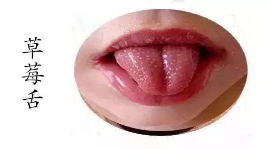 正确的舌诊（掌握舌诊魔术）(4)