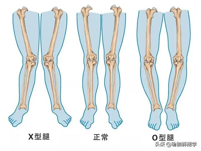 x型腿矫正的瑜伽方法（练瑜伽什么是）(3)