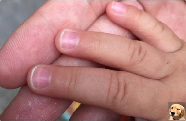 宝宝指甲软是什么原因造成的（宝宝指甲软说明缺钙）(5)