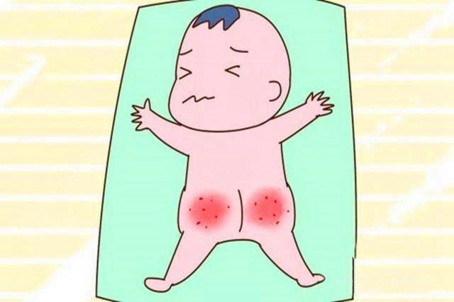 宝宝长尿布疹为何会反反复复的（宝宝出现尿布疹）