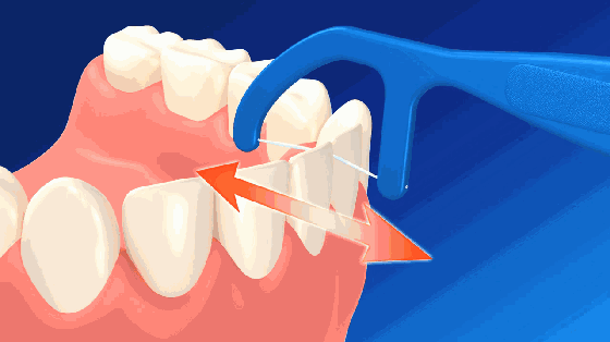 牙齿怎么样才能刷牙（牙齿到底怎么刷）(6)