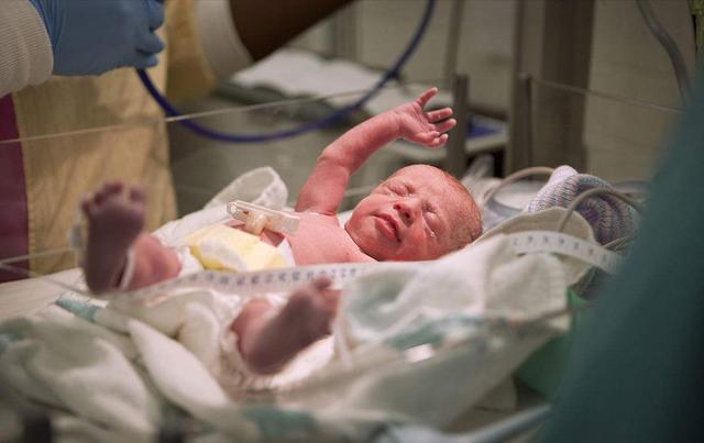 七个月早产婴儿存活率有多高（你见过最小的早产儿多少周出生的）(3)