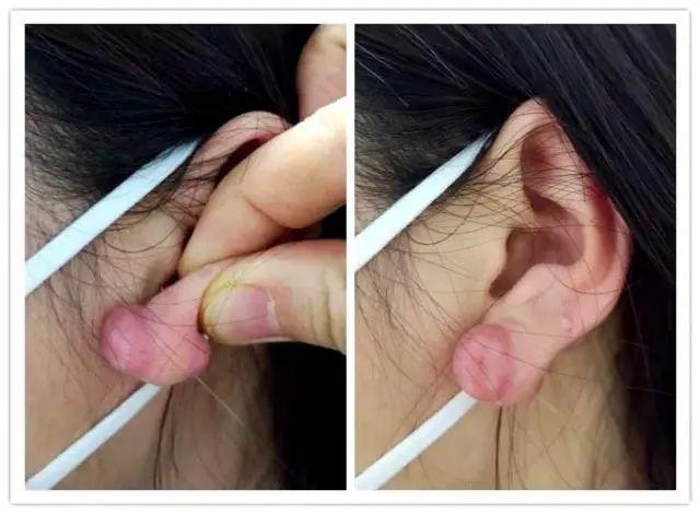 耳垂厚如何穿耳洞（穿耳洞小心了小耳洞）(2)