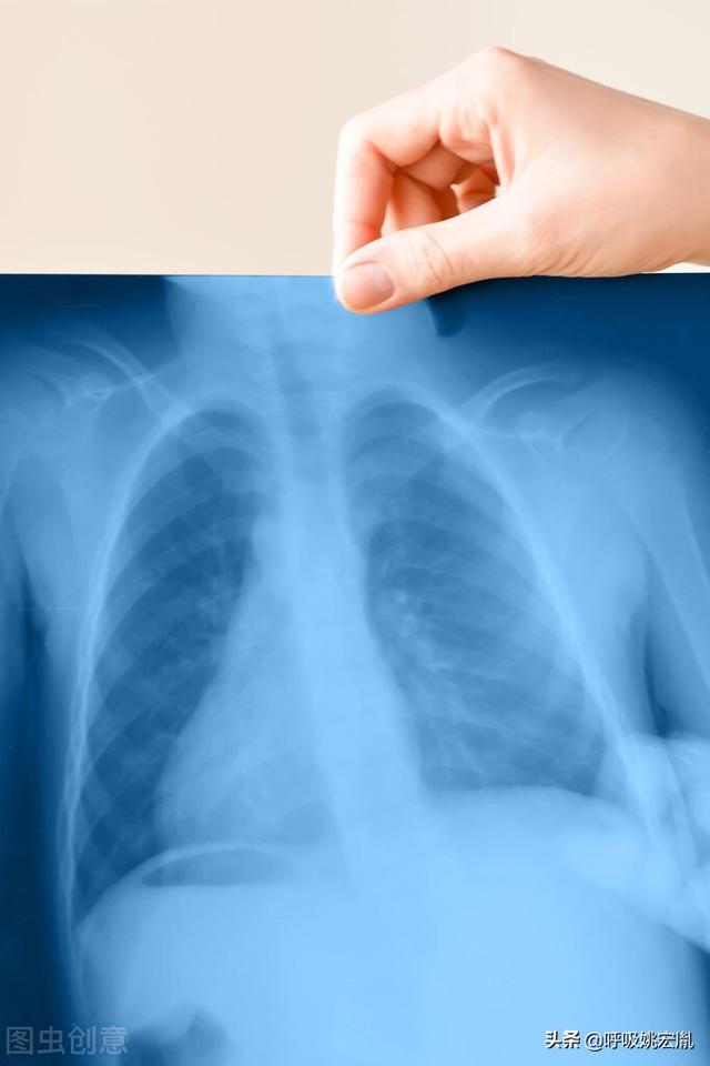肺结节到肺癌要多久（肺结节是怎么形成的）(1)
