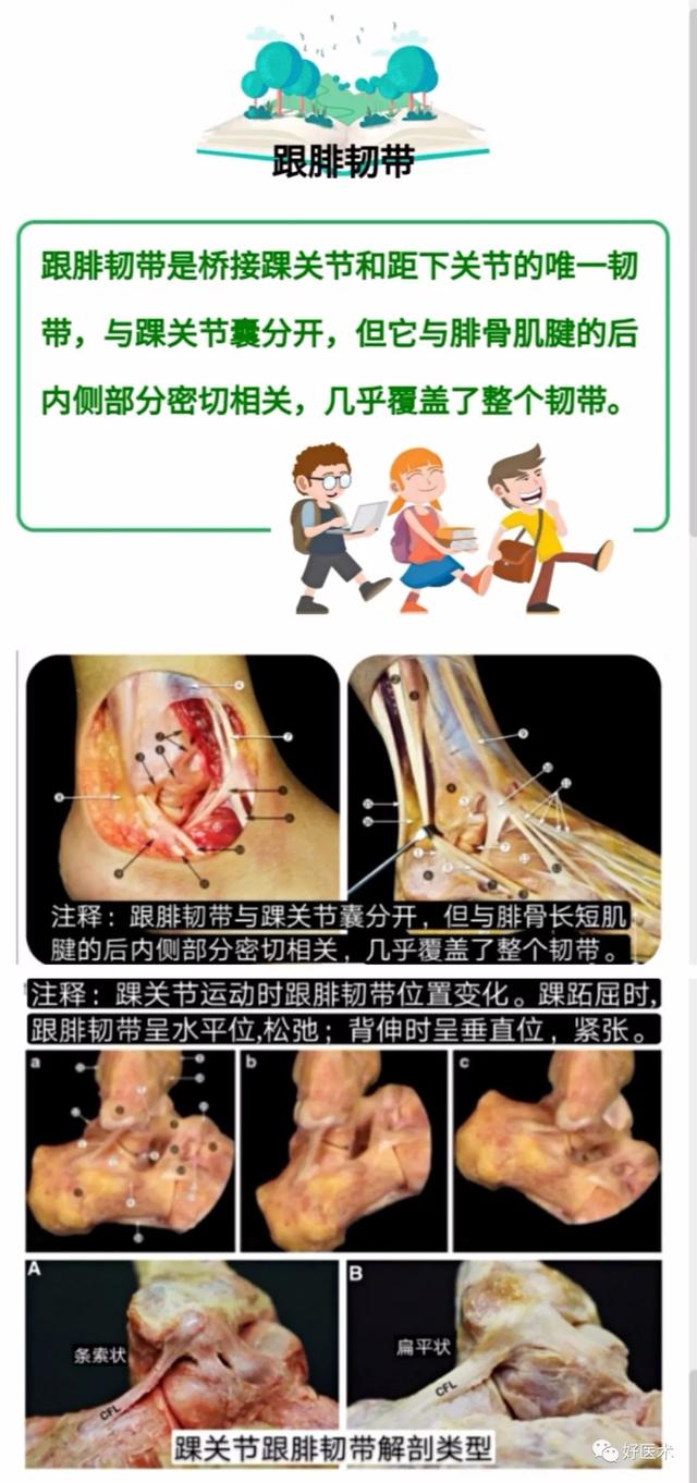 踝关节韧带mri解剖图（踝关节周围韧带的解剖及MRI特征）(3)