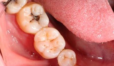 没有缝隙的牙线怎么使用（你会使用牙线吗）(4)