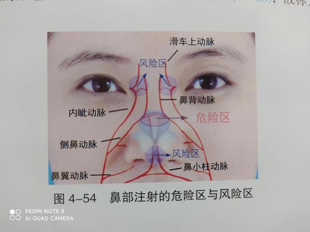 玻尿酸脸部注射有没有后遗症（打玻尿酸的女性注意了）(2)